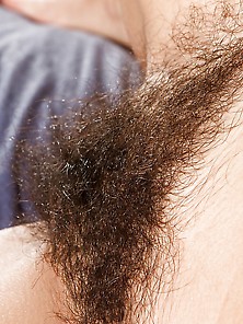 Hairy 8