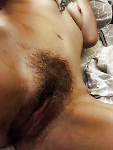 Hairy #8