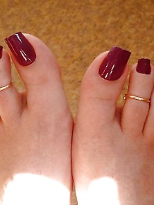 Long Toenails 14