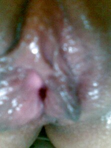 My Vulva :)
